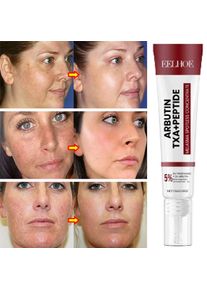 New Whitening Freckles Face Cream Removal Dark Spots Corrector Brighten Skin Fast Melanin Pigmentation Brighten for Beauty Care