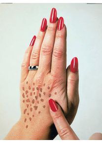 Damen Altersflecken-Creme in transparent ,Gr&ouml;&szlig;e 100 ml, WITT, 100% Medizinisches Gel