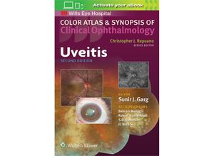 Uveitis (Color…
