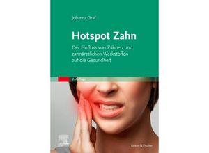 Hotspot Zahn -…