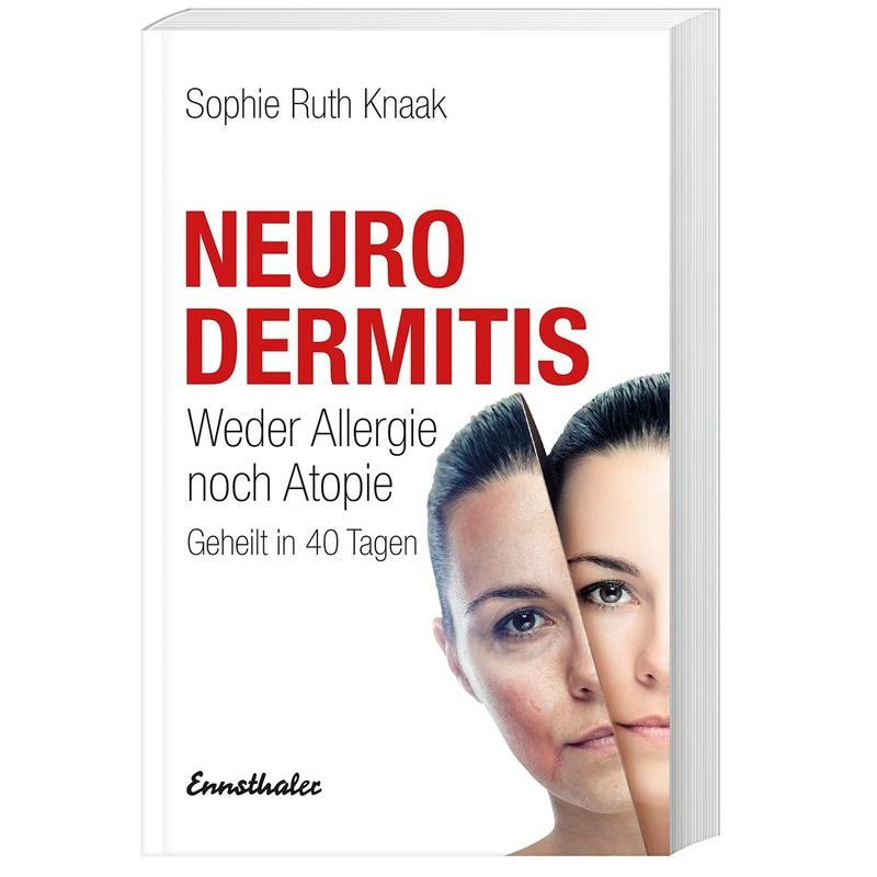 Neurodermitis - Sophie R. Knaak, Kartoniert (TB)